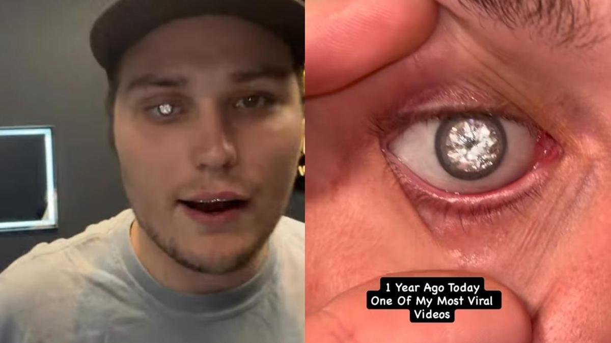 Cerita di Balik Viral Pria Punya Mata Palsu Berhiaskan Berlian Mewah