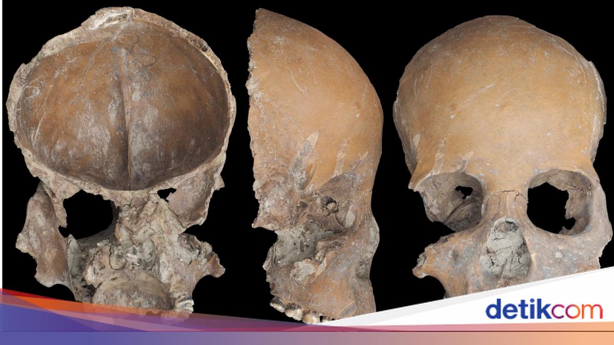 Orang China Kuno Jadikan Tulang Tengkorak Cawan dan Topeng