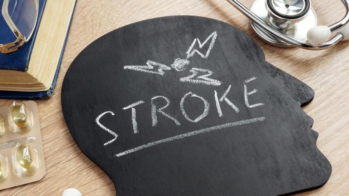 Stroke Bisa Menyerang Usia Muda, Ini Tanda Peringatan yang Harus Dikenali