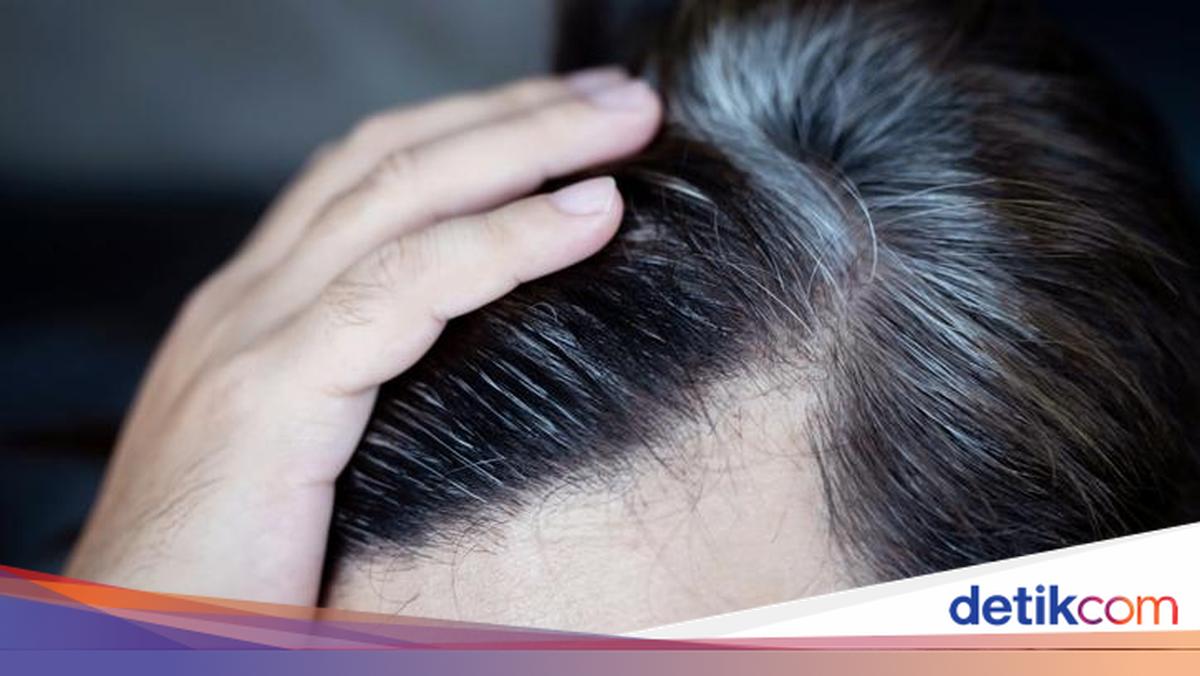 Uban Bisa Hilang? Ilmuwan Temukan Kunci agar Rambut Kembali ke Warna Aslinya!